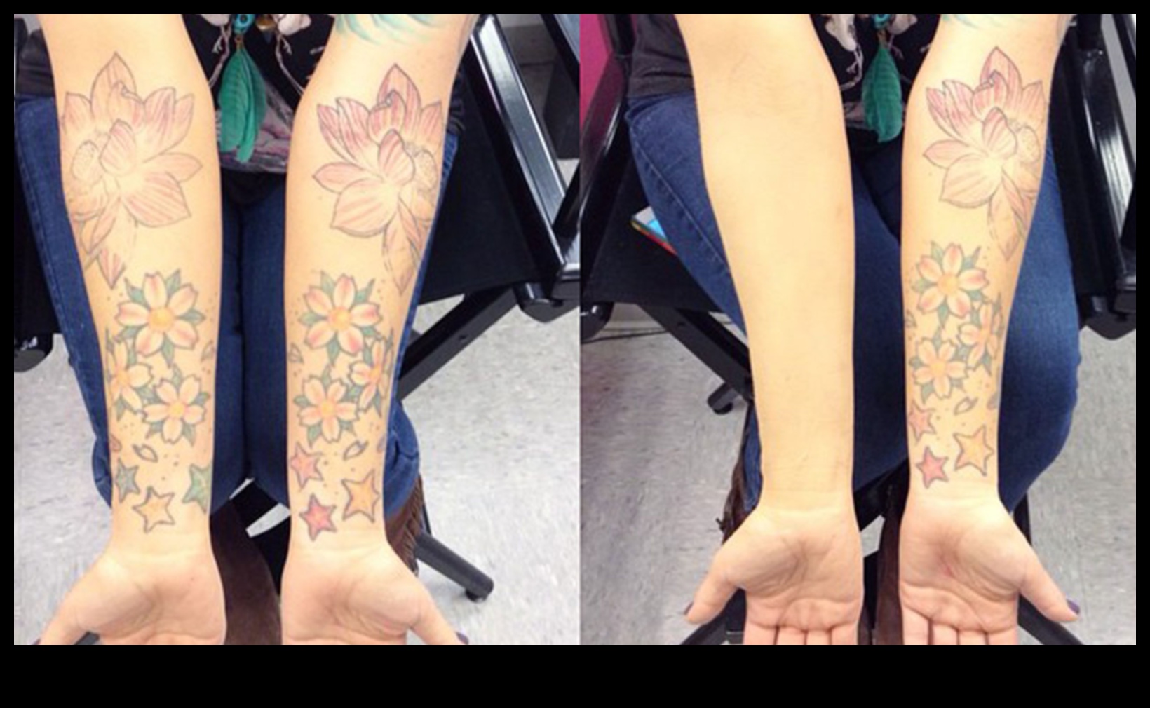 אומנות הסוואה איך להסתיר כמו מקצוען 2 אומנות הסוואה: שליטה בטכניקה של יישום קונסילר